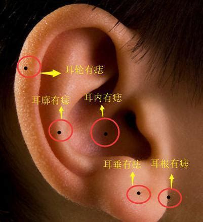 耳輪有痣|耳朵长痣的位置图解 耳朵长痣的位置图解有福气